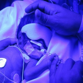 Antifaz para protección ocular, neonatal...